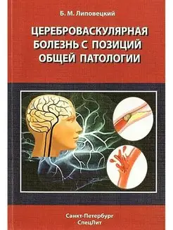 Цереброваскулярная болезнь с позиций общ