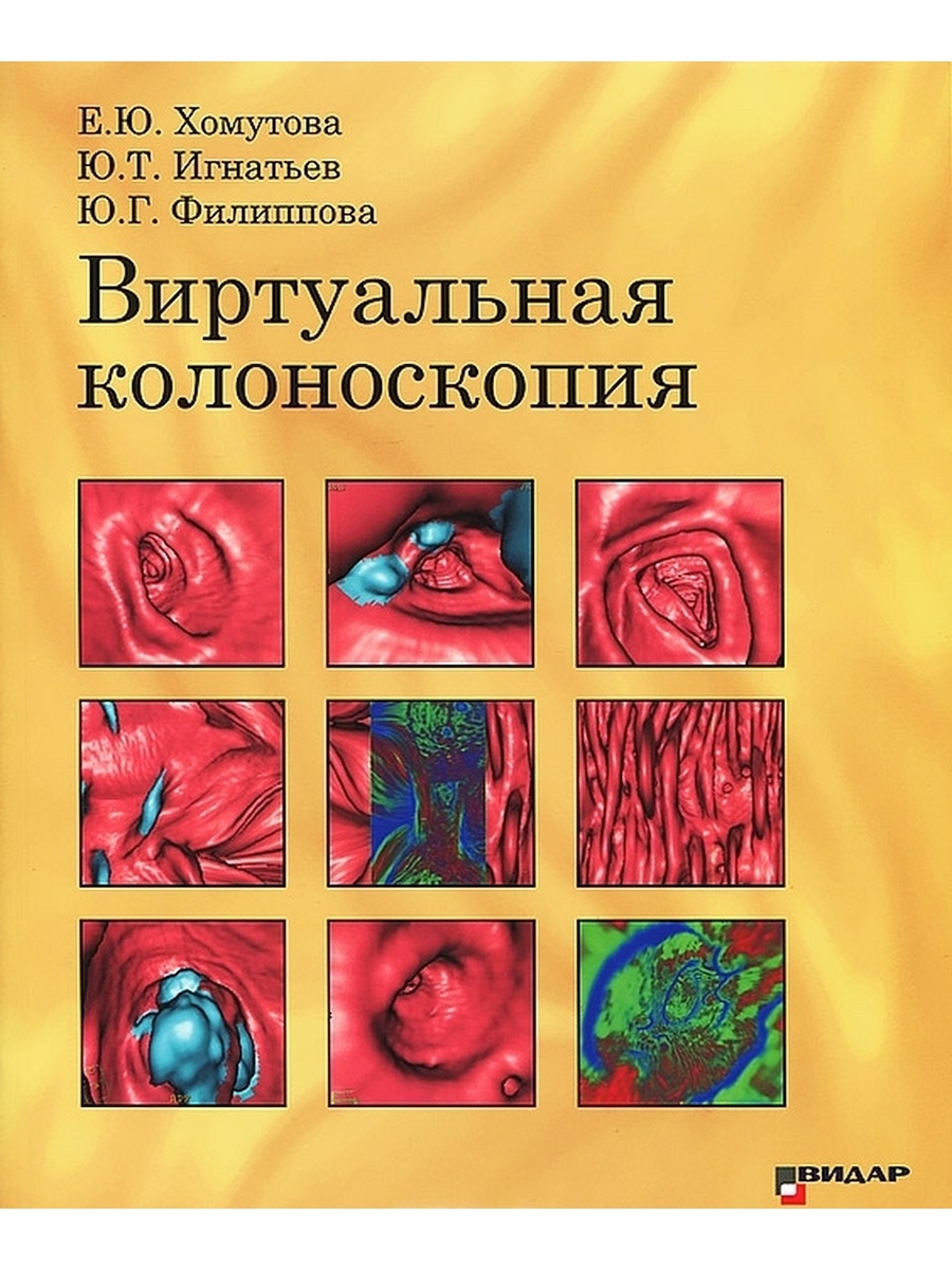 Виртуальноеколоноскопия. Виртуальная колоноскопия отзывы.