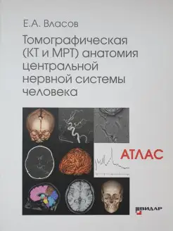 Томографическая (КТ и МРТ) анатомия цент