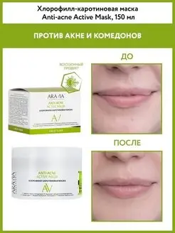 Хлорофилл-каротиновая маска Anti-Acne Active Mask, 150 мл