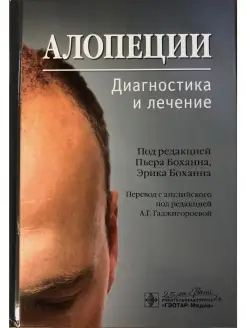 Алопеции. Диагностика и лечение