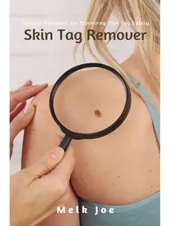 Skin Tag Remover. Natural Remedies fo