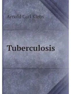 Tuberculosis