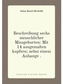 Beschreibung sechs menschlicher Missgeburten Mit 14