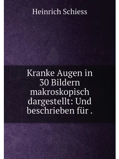 Kranke Augen in 30 Bildern makroskopisch dargestellt